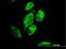 Mitochondrial Ribosomal Protein L1 antibody, H00065008-B01P, Novus Biologicals, Immunofluorescence image 