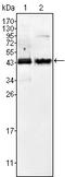 Alpha-Methylacyl-CoA Racemase antibody, A02217, Boster Biological Technology, Western Blot image 