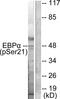 CCAAT Enhancer Binding Protein Alpha antibody, PA5-37520, Invitrogen Antibodies, Western Blot image 