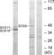 SRY-Box 8 antibody, abx013547, Abbexa, Western Blot image 