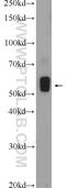 Desmin antibody, 22205-1-AP, Proteintech Group, Western Blot image 