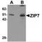 Solute Carrier Family 39 Member 7 antibody, MBS151439, MyBioSource, Western Blot image 