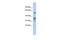 RAB3A Interacting Protein antibody, PA5-44020, Invitrogen Antibodies, Western Blot image 