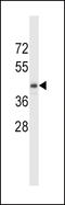 Tryptophan 2,3-Dioxygenase antibody, LS-C161783, Lifespan Biosciences, Western Blot image 