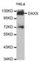 Death Domain Associated Protein antibody, abx000585, Abbexa, Western Blot image 