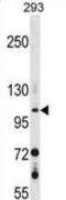 Retinal guanylyl cyclase 2 antibody, abx029185, Abbexa, Western Blot image 