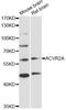 Activin A Receptor Type 2A antibody, MBS129591, MyBioSource, Western Blot image 