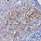 Superoxide Dismutase 2 antibody, GTX09013, GeneTex, Immunohistochemistry paraffin image 