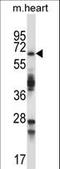 Tripartite Motif Containing 45 antibody, LS-C160198, Lifespan Biosciences, Western Blot image 