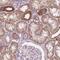 RAB20, Member RAS Oncogene Family antibody, PA5-64377, Invitrogen Antibodies, Immunohistochemistry paraffin image 