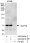 Decapping MRNA 1B antibody, A303-640A, Bethyl Labs, Immunoprecipitation image 