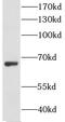 Glycosylphosphatidylinositol Anchor Attachment 1 antibody, FNab03574, FineTest, Western Blot image 