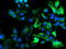 Dolichyl-diphosphooligosaccharide--protein glycosyltransferase 67 kDa subunit antibody, LS-C173362, Lifespan Biosciences, Immunofluorescence image 