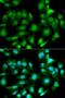 Glutathione S-transferase Mu 2 antibody, LS-C331351, Lifespan Biosciences, Immunofluorescence image 