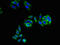 Chromosome 3 Open Reading Frame 18 antibody, LS-C398279, Lifespan Biosciences, Immunofluorescence image 