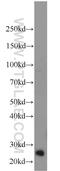 Thymidine Kinase 1 antibody, 15691-1-AP, Proteintech Group, Western Blot image 