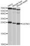 Glutathione S-Transferase Mu 3 antibody, A3905, ABclonal Technology, Western Blot image 