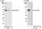 ADP Ribosylation Factor GTPase Activating Protein 3 antibody, A302-032A, Bethyl Labs, Immunoprecipitation image 