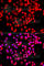Ribosomal Protein S6 Kinase Like 1 antibody, A7483, ABclonal Technology, Immunofluorescence image 