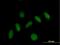 Pleckstrin Homology Domain Containing J1 antibody, H00055111-B01P, Novus Biologicals, Immunocytochemistry image 