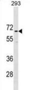 Coiled-Coil Domain Containing 151 antibody, abx030213, Abbexa, Western Blot image 