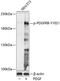 Platelet Derived Growth Factor Receptor Beta antibody, A00096Y1021, Boster Biological Technology, Western Blot image 