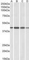 ArfGAP With Dual PH Domains 1 antibody, MBS420534, MyBioSource, Western Blot image 