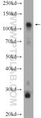 Hexokinase 1 antibody, 15656-1-AP, Proteintech Group, Western Blot image 