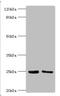 Mycobacterium tuberculosis Immunogenic protein MPT64 antibody, A57629-100, Epigentek, Western Blot image 