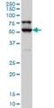 Serine/Threonine Kinase 17a antibody, H00009263-M03, Novus Biologicals, Western Blot image 