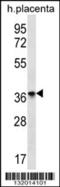 Olfactory Receptor Family 8 Subfamily D Member 4 antibody, 56-490, ProSci, Western Blot image 