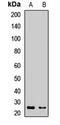 Lipocalin 2 antibody, LS-C667941, Lifespan Biosciences, Western Blot image 