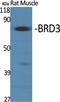 Bromodomain Containing 3 antibody, A04044, Boster Biological Technology, Western Blot image 