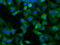 Nucleoredoxin Like 2 antibody, M16303, Boster Biological Technology, Immunofluorescence image 