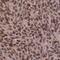 Heterogeneous Nuclear Ribonucleoprotein D antibody, FNab03950, FineTest, Immunohistochemistry paraffin image 