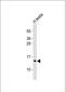 Purkinje Cell Protein 2 antibody, PA5-49455, Invitrogen Antibodies, Western Blot image 