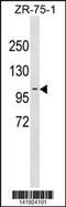 Programmed Cell Death 6 Interacting Protein antibody, 60-809, ProSci, Western Blot image 