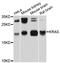 KRAS Proto-Oncogene, GTPase antibody, STJ114577, St John