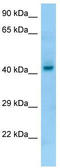 Pepsin A antibody, TA338325, Origene, Western Blot image 