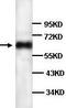 LOL antibody, TA310116, Origene, Western Blot image 