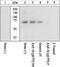 Zeta Chain Of T Cell Receptor Associated Protein Kinase 70 antibody, 44-230G, Invitrogen Antibodies, Western Blot image 
