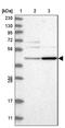 G Protein-Coupled Estrogen Receptor 1 antibody, NBP1-88096, Novus Biologicals, Western Blot image 