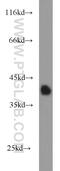 Serine Protease 8 antibody, 15527-1-AP, Proteintech Group, Western Blot image 