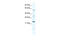 Casein Kinase 1 Gamma 1 antibody, 28-691, ProSci, Western Blot image 