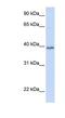 Tetraspanin 10 antibody, NBP1-91356, Novus Biologicals, Western Blot image 