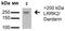 Leucine Rich Repeat Kinase 2 antibody, NBP2-42175, Novus Biologicals, Western Blot image 