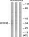 Olfactory Receptor Family 5 Subfamily H Member 6 (Gene/Pseudogene) antibody, TA315780, Origene, Western Blot image 