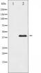 MEK1/2 antibody, TA325632, Origene, Western Blot image 