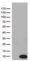 NADH dehydrogenase [ubiquinone] 1 alpha subcomplex subunit 2 antibody, M10396, Boster Biological Technology, Western Blot image 