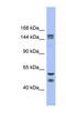 JHDM1B antibody, NBP1-80379, Novus Biologicals, Western Blot image 